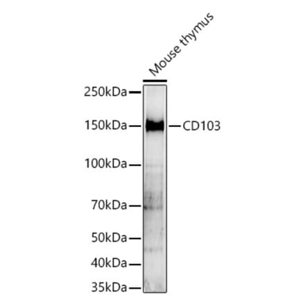 Western Blot - Anti-CD103 Antibody (A329188) - Antibodies.com