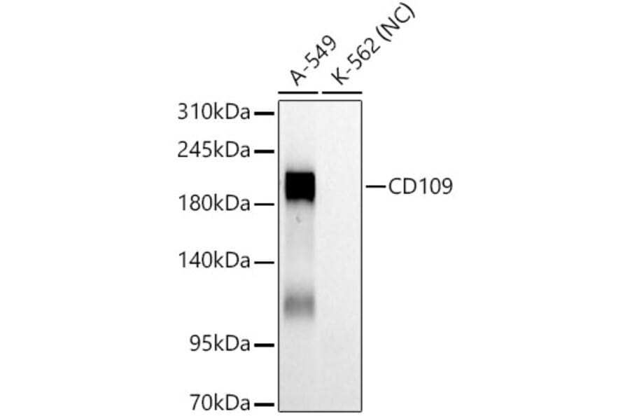 Western Blot - Anti-CD109 Antibody [ARC61642] (A329190) - Antibodies.com