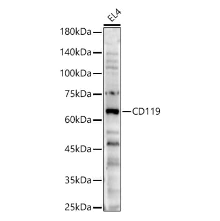 Western Blot - Anti-CD119 Antibody (A329191) - Antibodies.com
