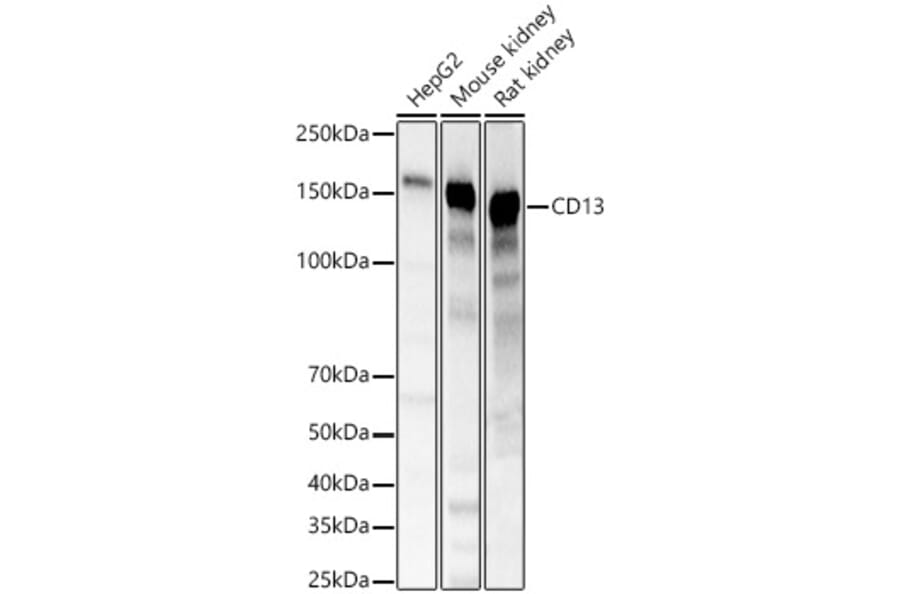 Western Blot - Anti-CD13 Antibody (A329194) - Antibodies.com