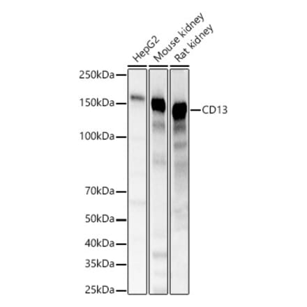 Western Blot - Anti-CD13 Antibody (A329194) - Antibodies.com