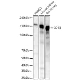 Western Blot - Anti-CD13 Antibody (A329194) - Antibodies.com
