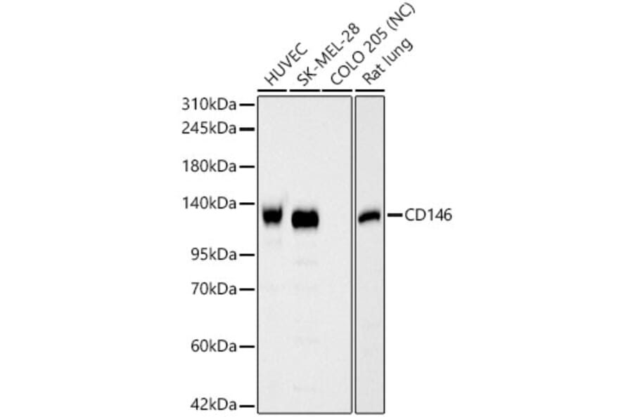 Western Blot - Anti-CD146 Antibody (A329199) - Antibodies.com