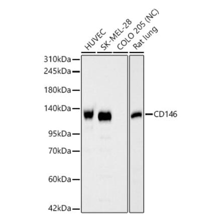 Western Blot - Anti-CD146 Antibody (A329199) - Antibodies.com