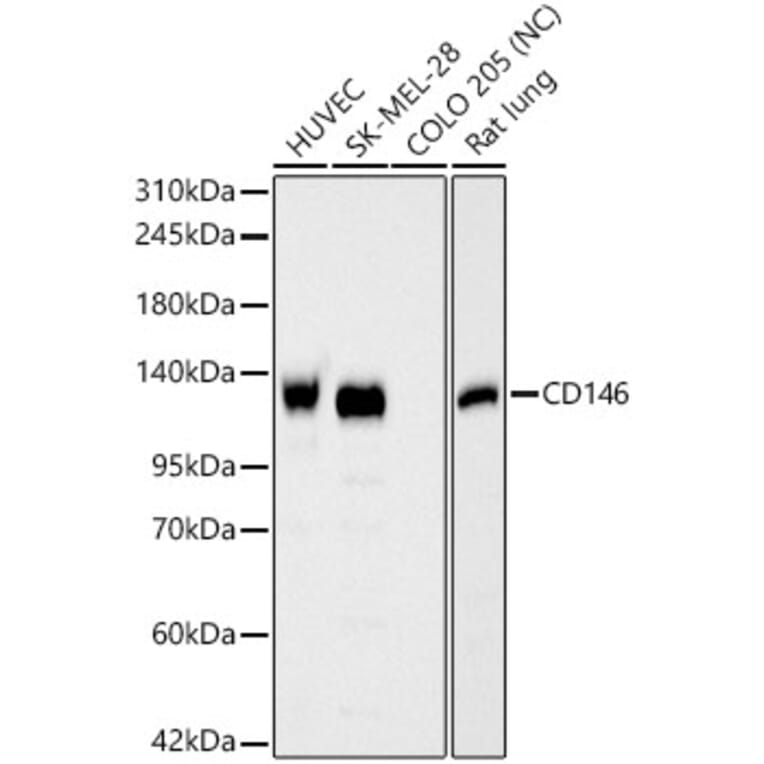 Western Blot - Anti-CD146 Antibody (A329199) - Antibodies.com