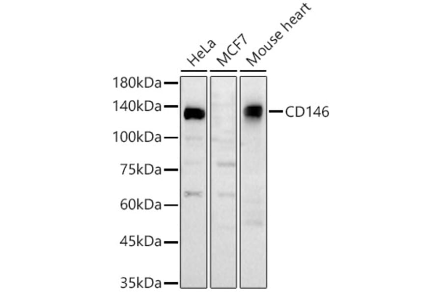 Western Blot - Anti-CD146 Antibody (A329200) - Antibodies.com