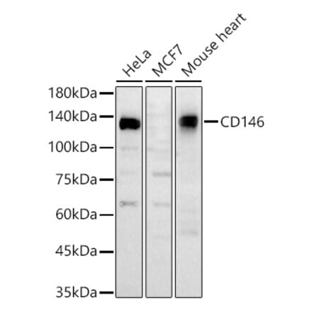 Western Blot - Anti-CD146 Antibody (A329200) - Antibodies.com