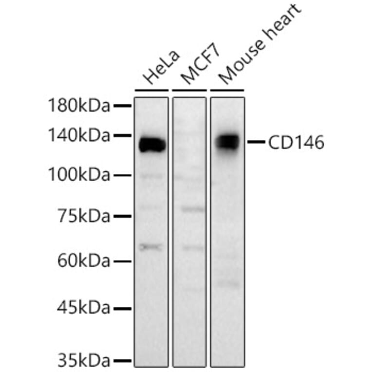 Western Blot - Anti-CD146 Antibody (A329200) - Antibodies.com