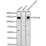 Western Blot - Anti-CD146 Antibody (A329200) - Antibodies.com
