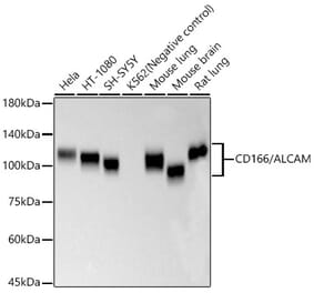 Western Blot - Anti-CD166 Antibody [ARC57940] (A329201) - Antibodies.com