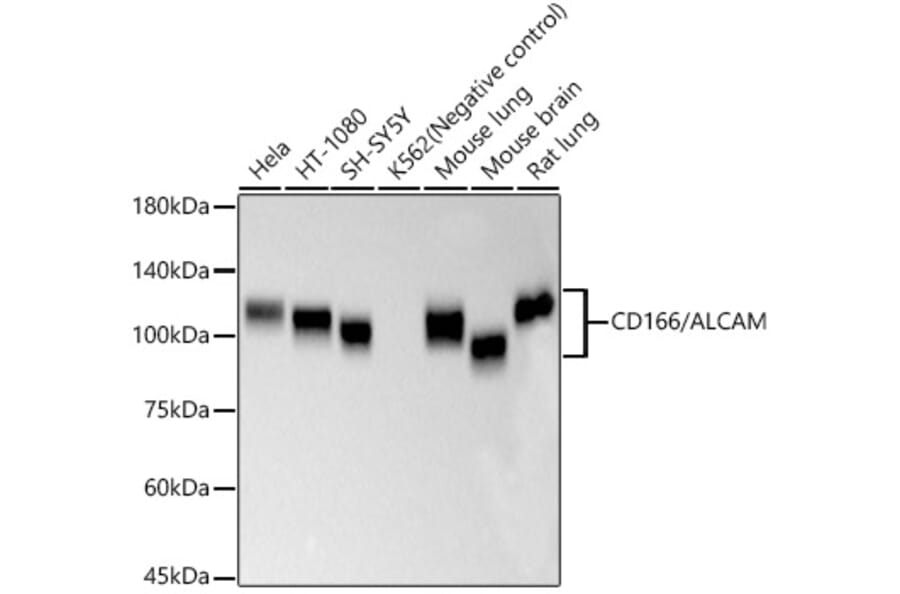 Western Blot - Anti-CD166 Antibody [ARC57940] (A329201) - Antibodies.com