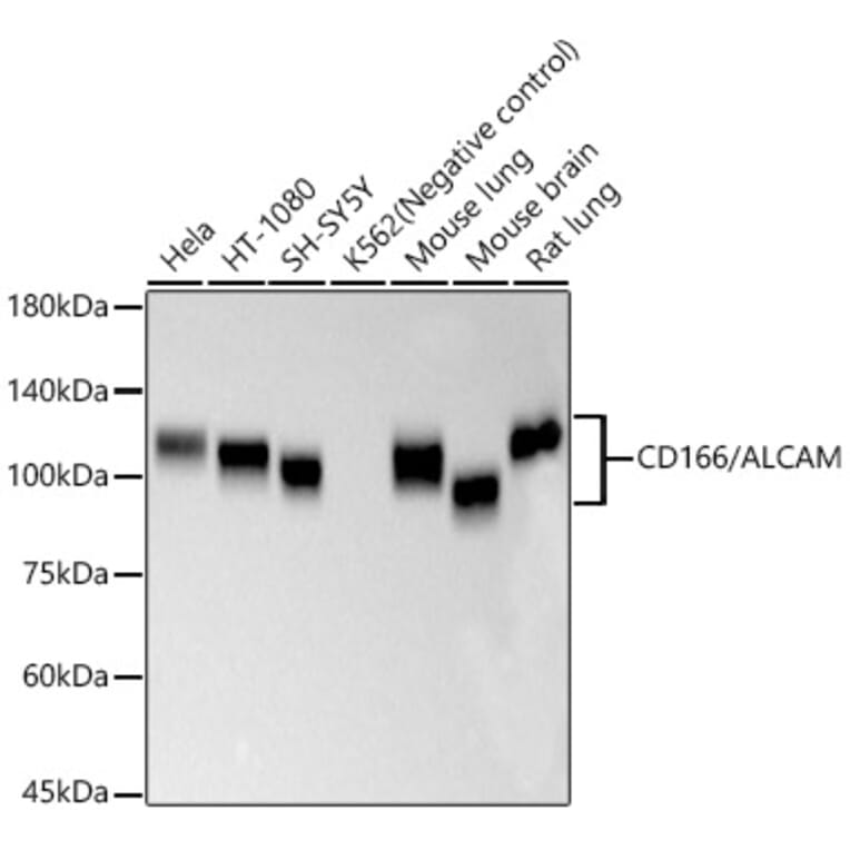 Western Blot - Anti-CD166 Antibody [ARC57940] (A329201) - Antibodies.com