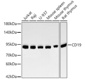 Western Blot - Anti-CD19 Antibody (A329204) - Antibodies.com
