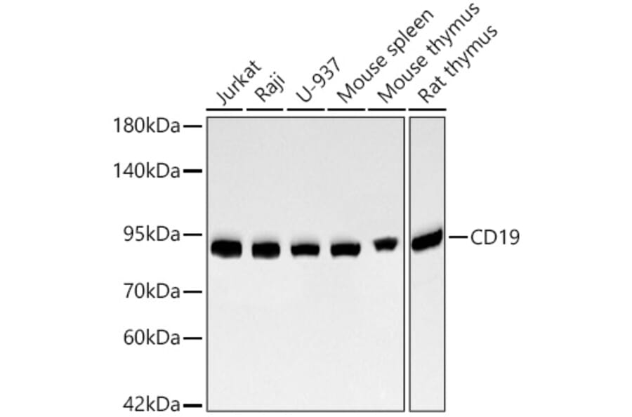 Western Blot - Anti-CD19 Antibody [ARC2655] (A329204) - Antibodies.com