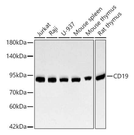 Western Blot - Anti-CD19 Antibody [ARC2655] (A329204) - Antibodies.com