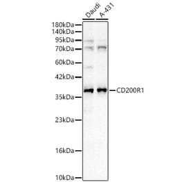 Western Blot - Anti-CD200R Antibody (A329205) - Antibodies.com