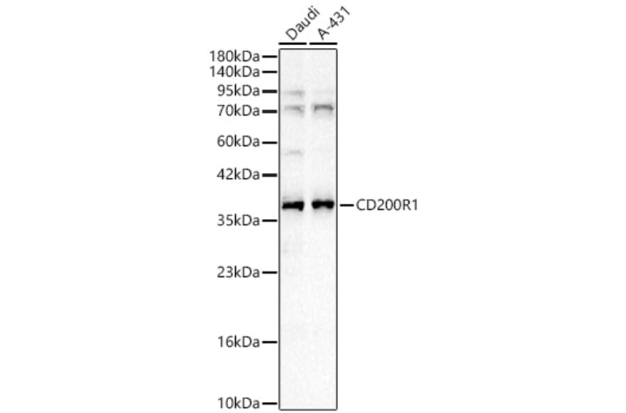 Western Blot - Anti-CD200R Antibody (A329205) - Antibodies.com