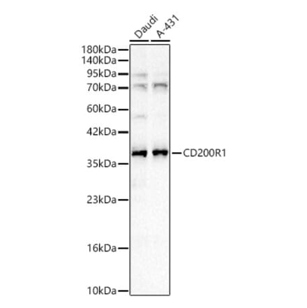Western Blot - Anti-CD200R Antibody (A329205) - Antibodies.com