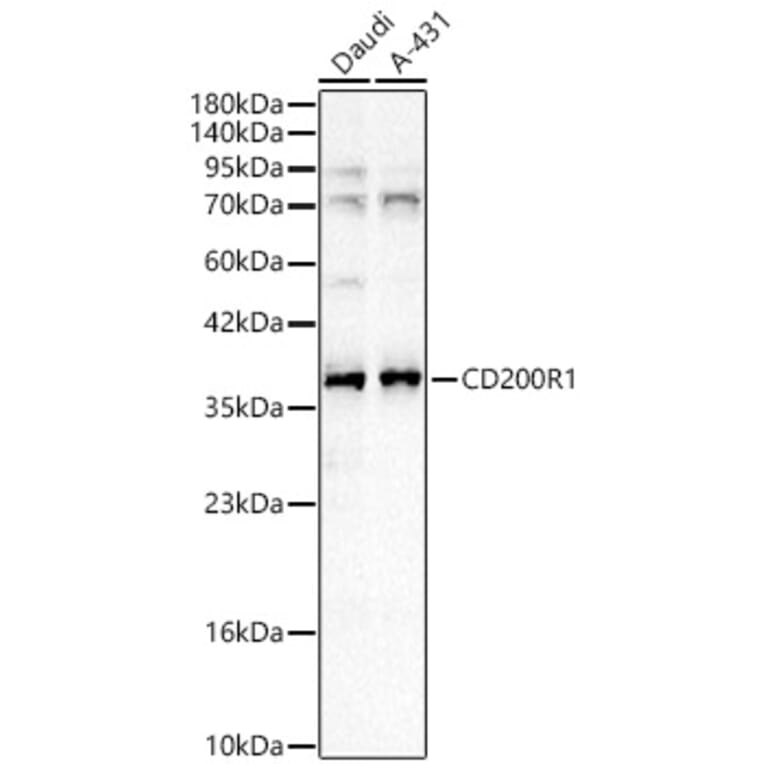 Western Blot - Anti-CD200R Antibody (A329205) - Antibodies.com