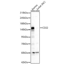 Western Blot - Anti-CD22 Antibody (A329206) - Antibodies.com
