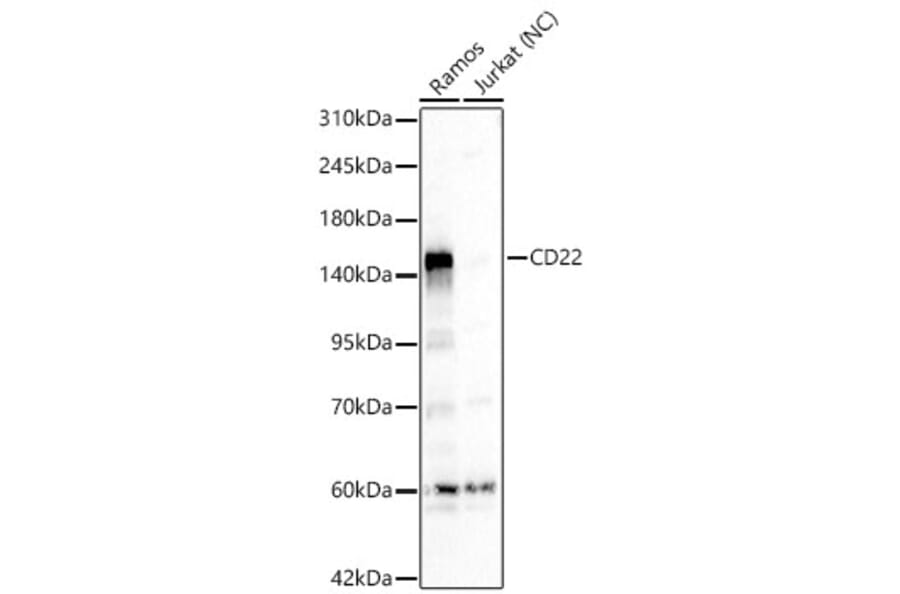 Western Blot - Anti-CD22 Antibody (A329206) - Antibodies.com