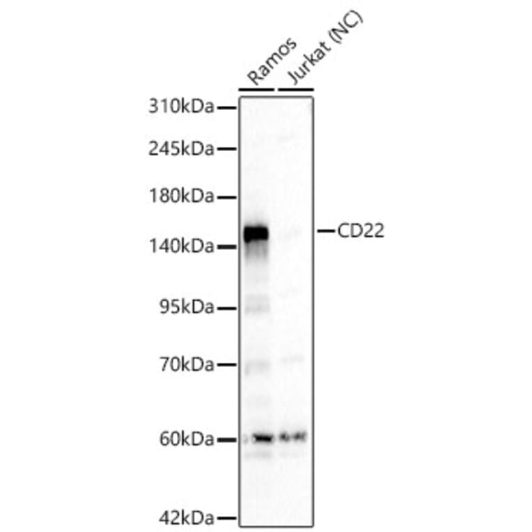Western Blot - Anti-CD22 Antibody (A329206) - Antibodies.com