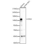 Western Blot - Anti-CD22 Antibody (A329206) - Antibodies.com