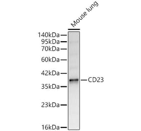 Western Blot - Anti-CD23 Antibody (A329207) - Antibodies.com