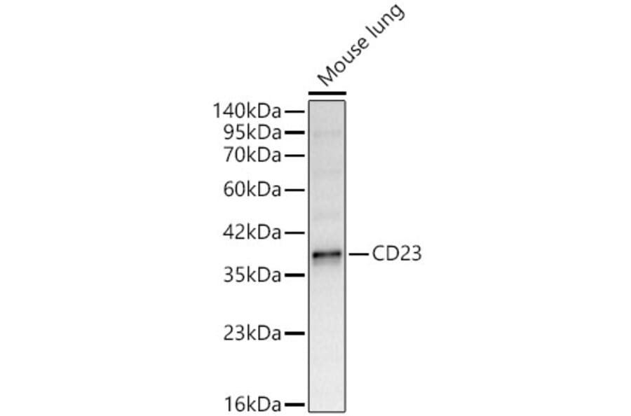 Western Blot - Anti-CD23 Antibody (A329207) - Antibodies.com