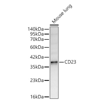 Western Blot - Anti-CD23 Antibody (A329207) - Antibodies.com