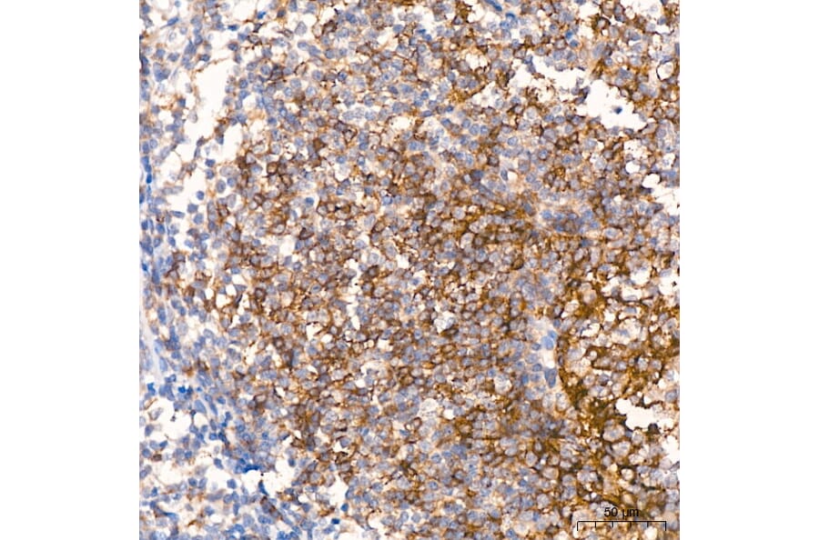 Immunohistochemistry - Anti-CD23 Antibody (A329207) - Antibodies.com