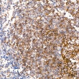 Immunohistochemistry - Anti-CD23 Antibody (A329207) - Antibodies.com