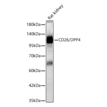 Western Blot - Anti-CD26 Antibody (A329211) - Antibodies.com