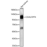 Western Blot - Anti-CD26 Antibody (A329211) - Antibodies.com