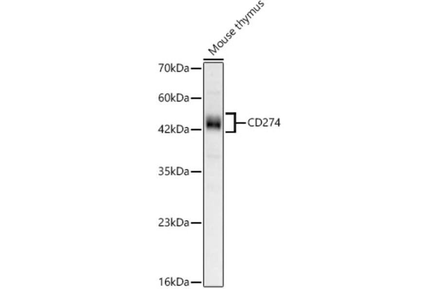Western Blot - Anti-CD274 Antibody (A329212) - Antibodies.com