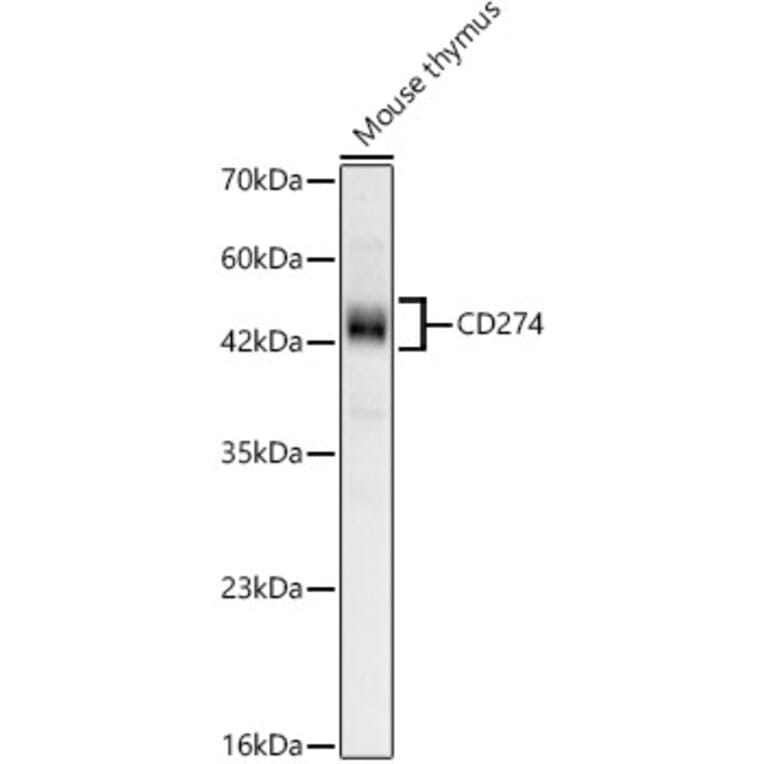 Western Blot - Anti-CD274 Antibody (A329212) - Antibodies.com