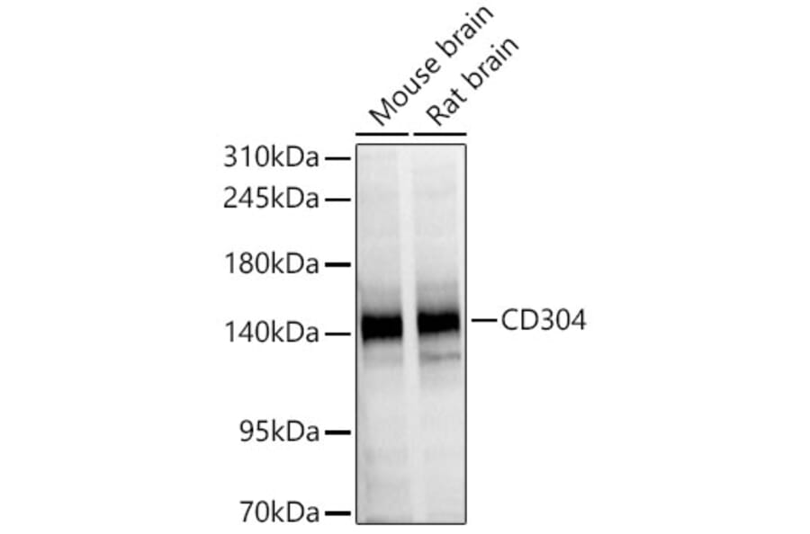 Western Blot - Anti-CD304 Antibody (A329213) - Antibodies.com