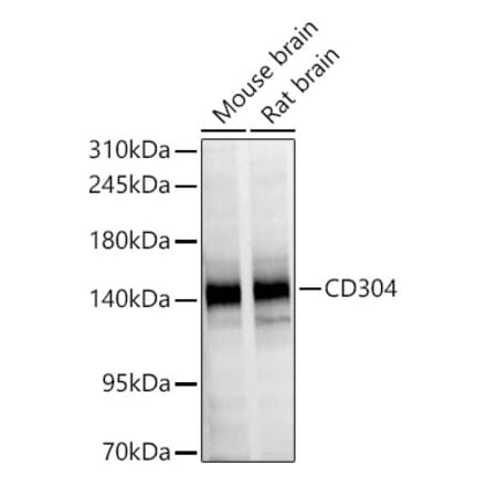 Western Blot - Anti-CD304 Antibody (A329213) - Antibodies.com