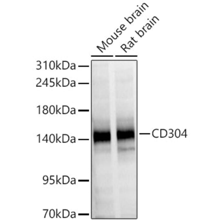 Western Blot - Anti-CD304 Antibody (A329213) - Antibodies.com