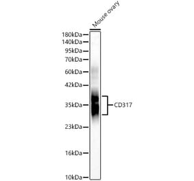 Western Blot - Anti-CD317 Antibody (A329214) - Antibodies.com