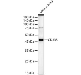 Western Blot - Anti-CD335 Antibody (A329215) - Antibodies.com