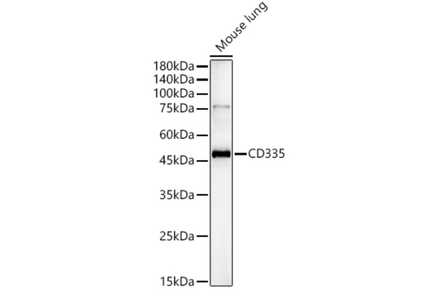 Western Blot - Anti-CD335 Antibody (A329215) - Antibodies.com