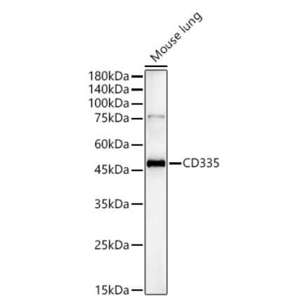 Western Blot - Anti-CD335 Antibody (A329215) - Antibodies.com