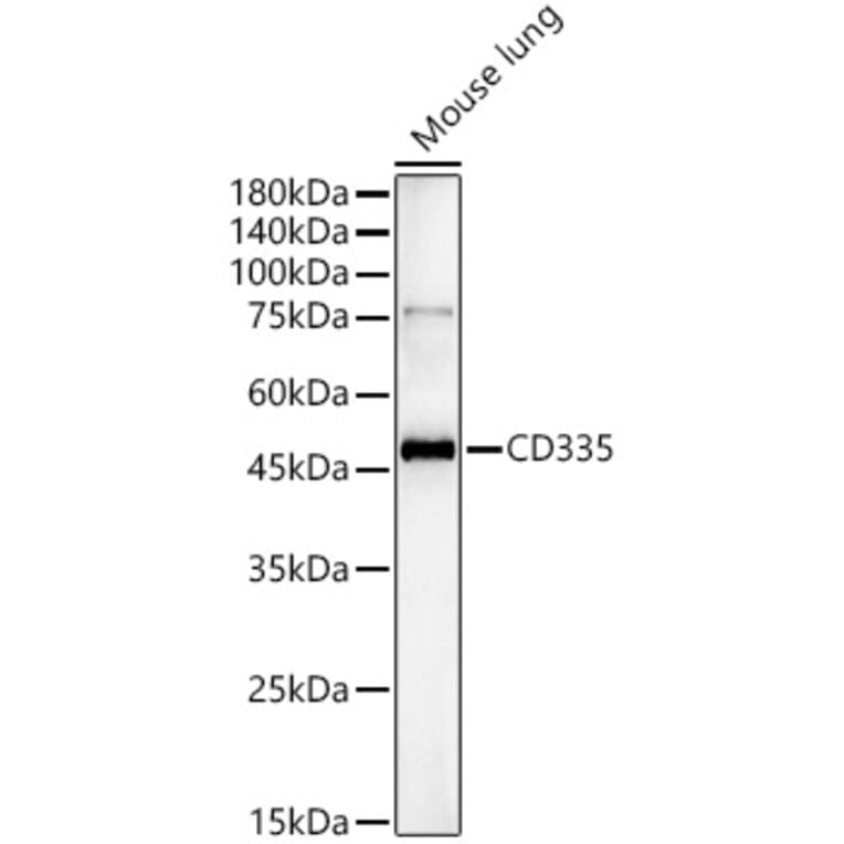 Western Blot - Anti-CD335 Antibody (A329215) - Antibodies.com