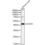 Western Blot - Anti-CD335 Antibody (A329215) - Antibodies.com