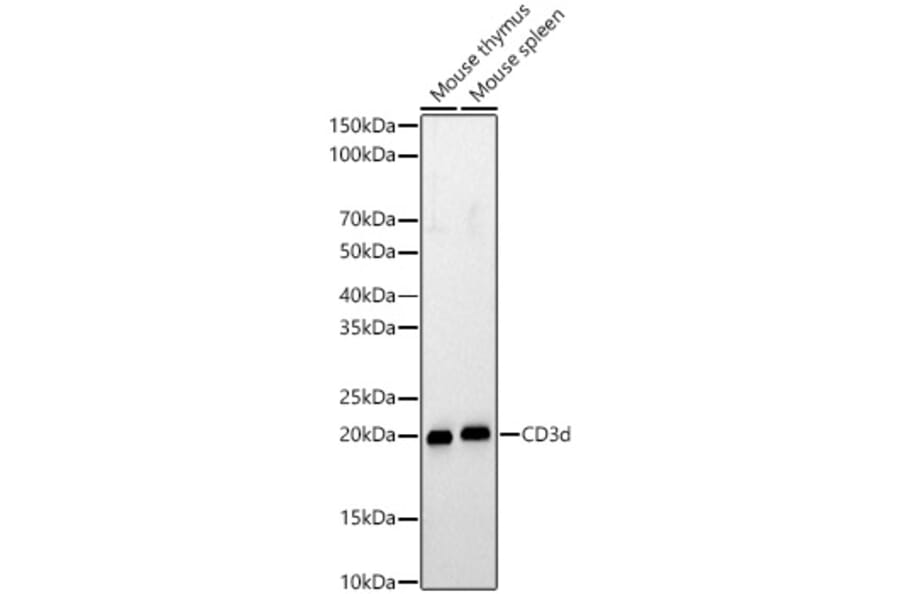 Western Blot - Anti-CD3d Antibody (A329216) - Antibodies.com