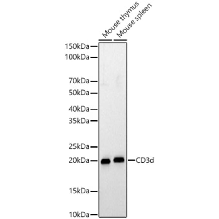 Western Blot - Anti-CD3d Antibody (A329216) - Antibodies.com