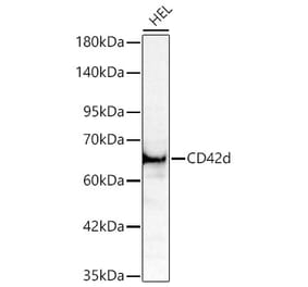 Western Blot - Anti-CD42d Antibody (A329219) - Antibodies.com