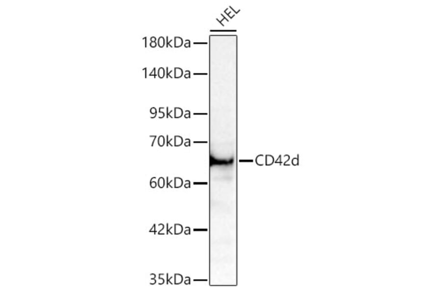 Western Blot - Anti-CD42d Antibody (A329219) - Antibodies.com