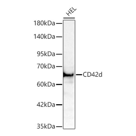 Western Blot - Anti-CD42d Antibody (A329219) - Antibodies.com